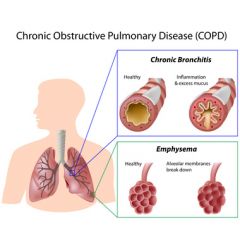 NUR178 - Overview of COPD Medications (1.0 HR)