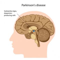NUR113 - Parkinson's Disease (2.5 HR)