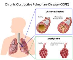 NUR178 - Overview of COPD Medications (1.0 HR)