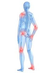 NUR106 - Rheumatoid Arthritis (1.0 HR)