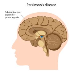 NUR113 - Parkinson’s Disease: Pathophysiology and Medications (2.0 HR)