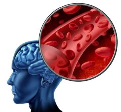 CNA125 - Caring for Stroke Patients (2.0 HR)