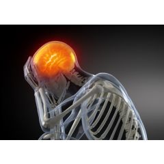NUR132 - Traumatic Brain Injury (1.0 HR)